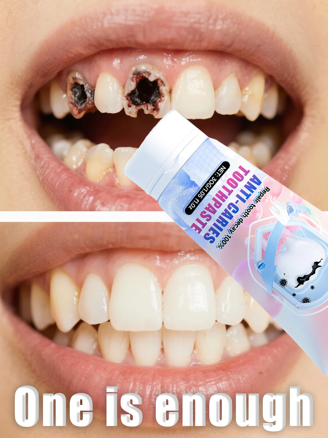 Remineralizing Toothpaste - ⁹⁹% ᵒᶠ ᵖᵉᵒᵖˡᵉ ʳᵉᵖᵘʳᶜʰᵃˢᵉ ᵗᵒ ʳᵉᵖᵃⁱʳ