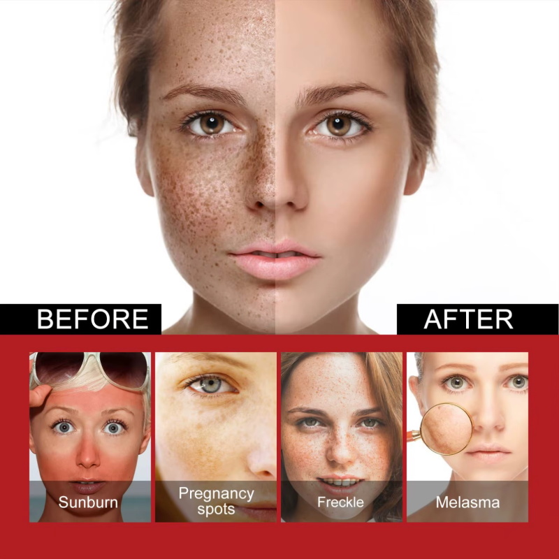 Powerful Spot-Removing Whiten  - Charcoal Whitening Paste recension och pris