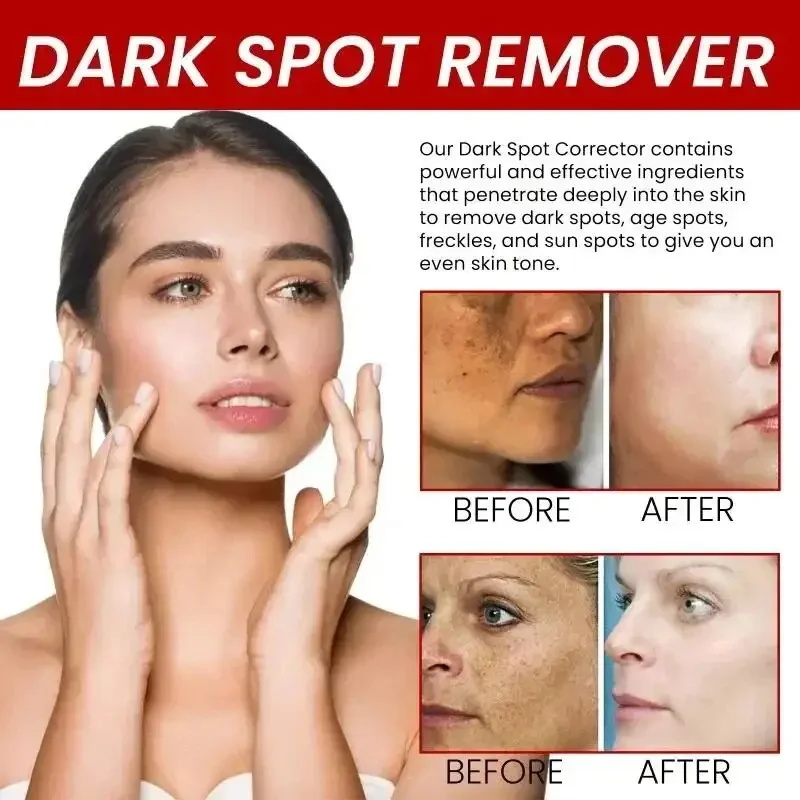 Powerful Spot-Removing Whiten  - Charcoal Whitening Paste recension och pris