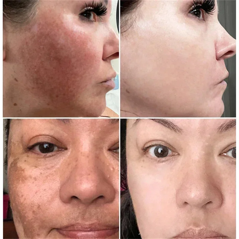 Powerful Spot-Removing Whiten  - Charcoal Whitening Paste recension och pris