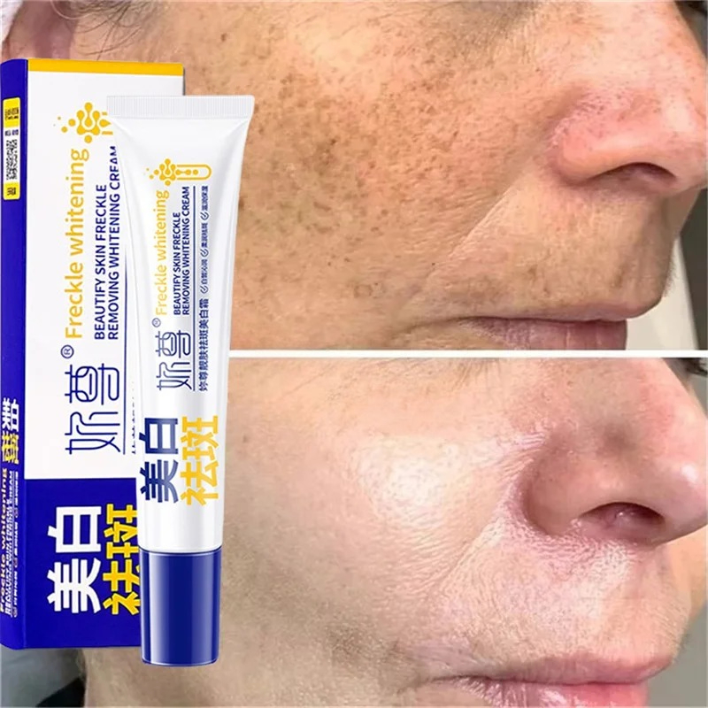 Powerful Spot-Removing Whiten  - Charcoal Whitening Paste recension och pris