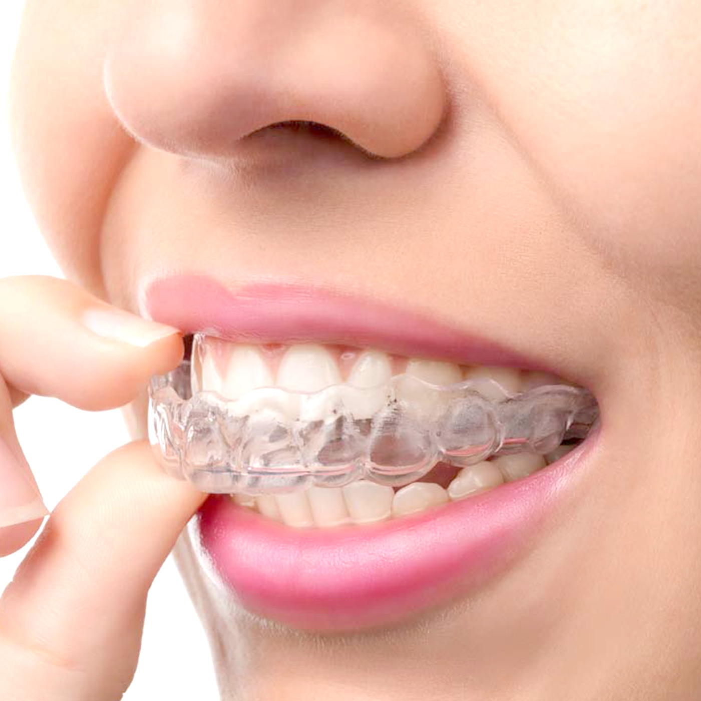 1Pc/2Pcs Transparent Teeth Tra - Teeth Whitening For Trays recension och pris