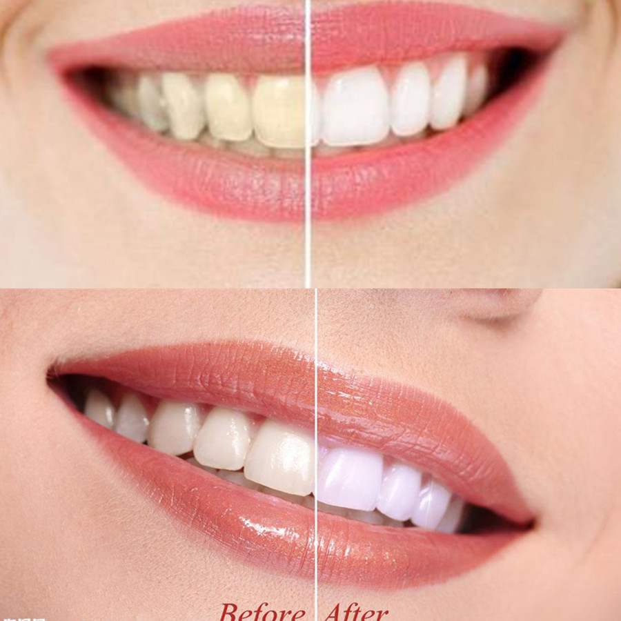 Bamboo Charcoal Teeth Tooth De - Teeth Whitening Near Me recension och pris