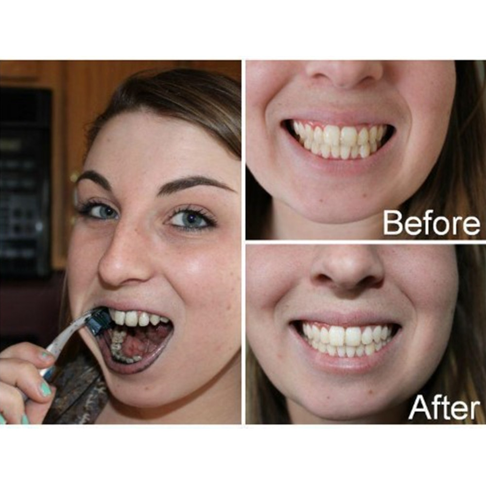 Bamboo Charcoal Teeth Tooth De - Teeth Whitening Near Me recension och pris