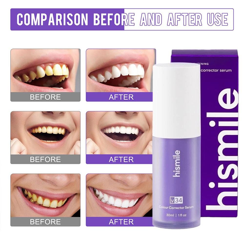 30ml Hismile V34 Purple Teeth  - Teeth Whitening Foam recension och pris