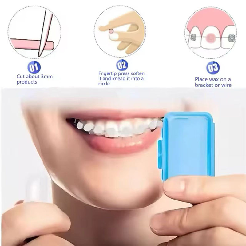 1set Orthodontic Dental Oral C - Teeth Whitening For Braces recension och pris