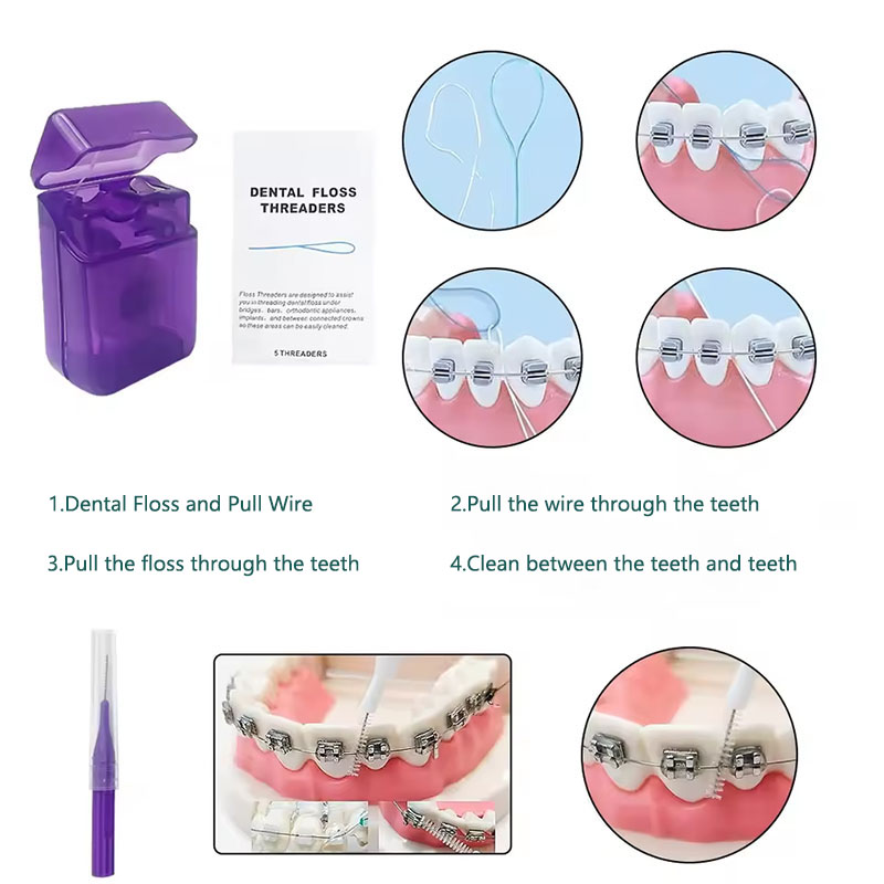 1set Orthodontic Dental Oral C - Teeth Whitening For Braces recension och pris