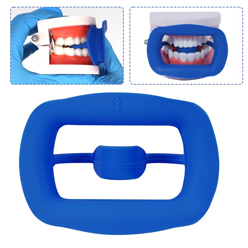 1pc Dental Mouth Opener Soft S - Teeth Whitening Zoom recension och pris