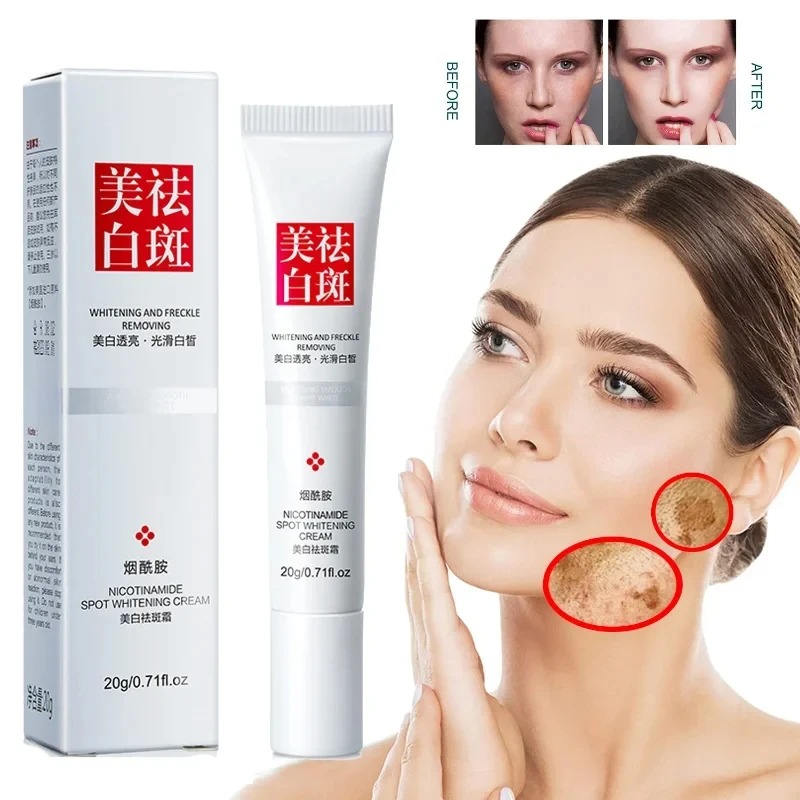 Fade and Improve Freckles Blac - Charcoal Whitening Paste recension och pris
