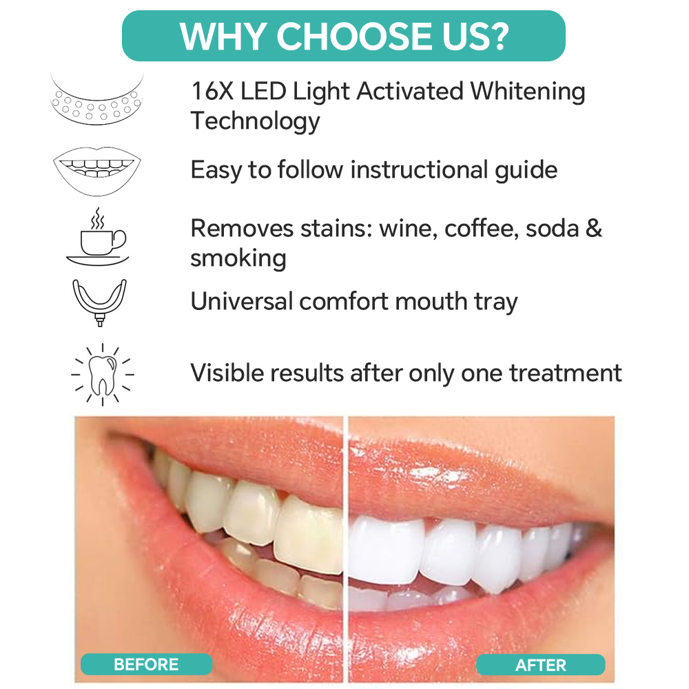 Teeth Whitening Accelerator Li - Teeth Whitening With Blue Light recension och pris