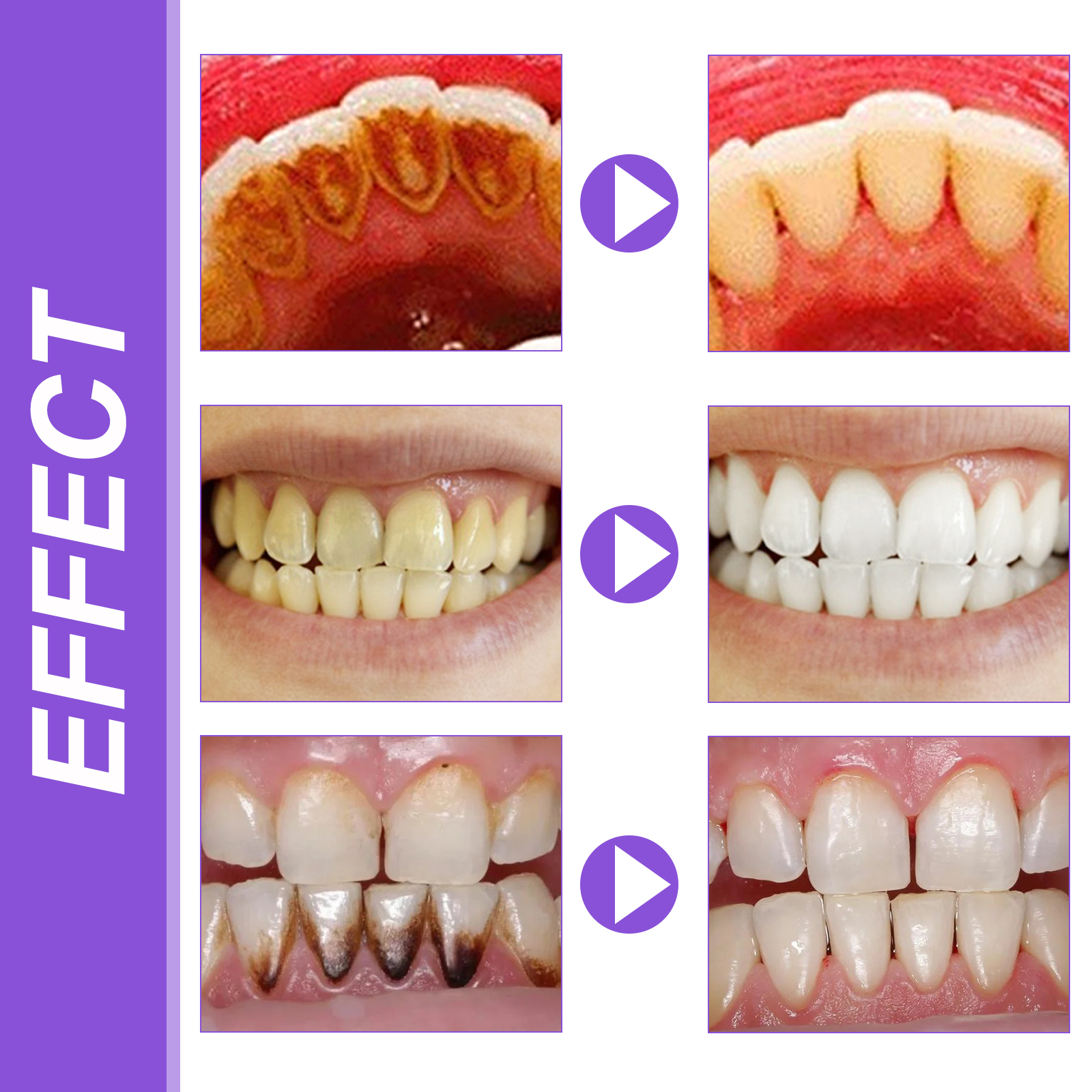 EELHOE Smiles Bright White Ref - Teeth Whitening Foam recension och pris