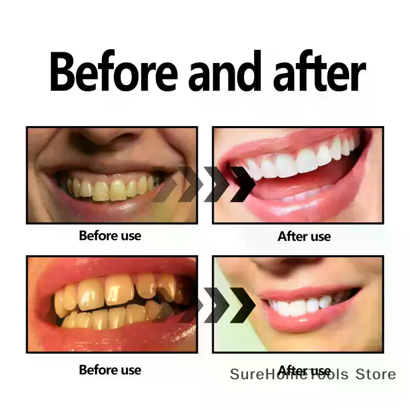Bamboo Charcoal Powder For Tee - Teeth Whitening Near Me recension och pris