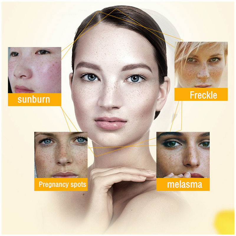 Dimollaure Whitening Freckle C - Charcoal Whitening Paste recension och pris