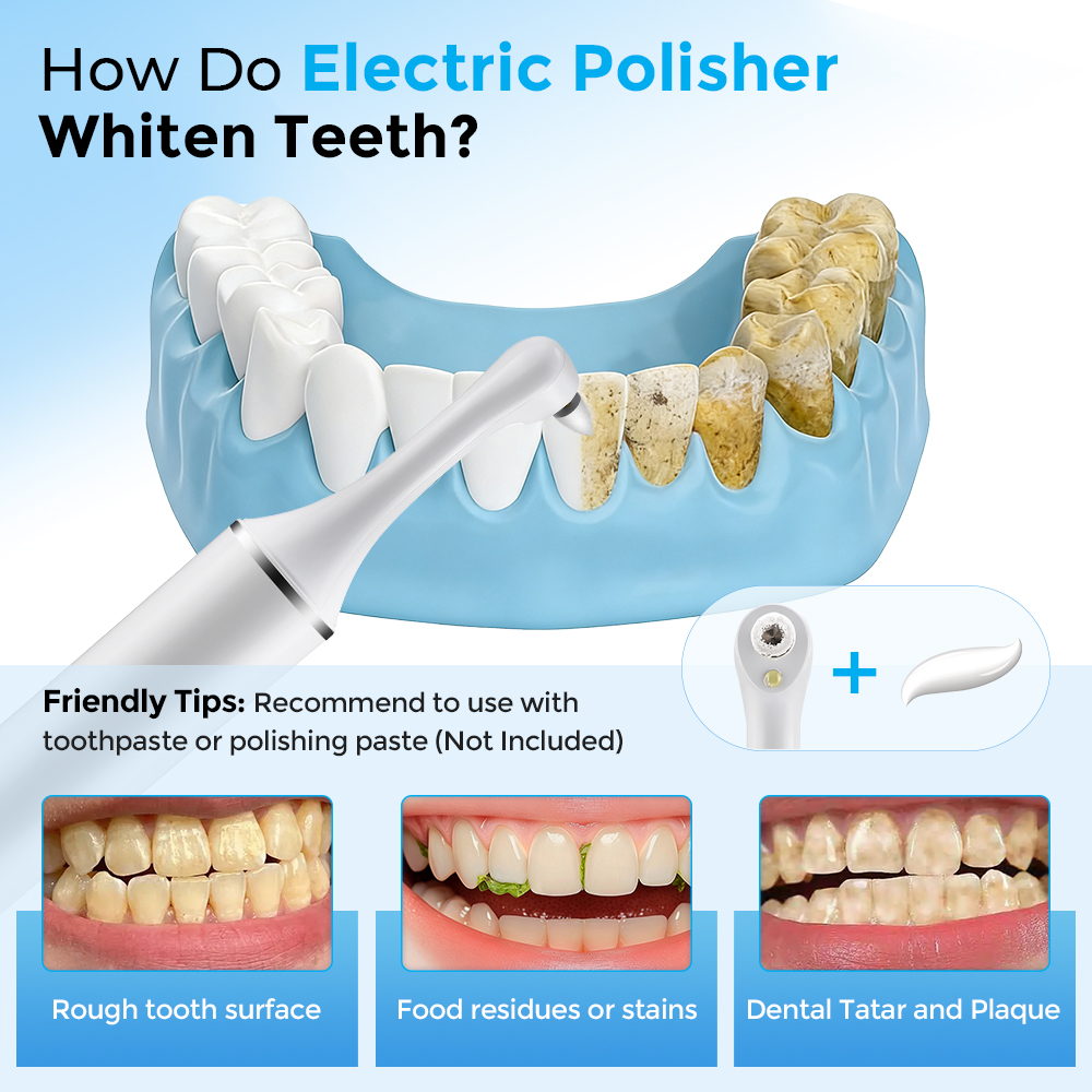 Electric Tooth Polisher Teeth  - Teeth Whitening With Led Light recension och pris