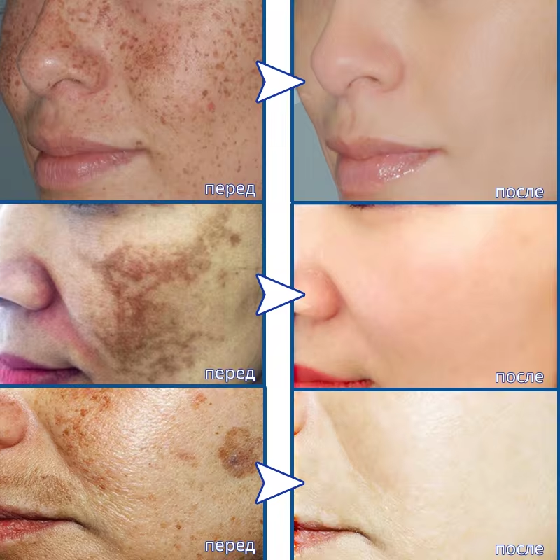 Powerful Spot-removing Whiteni - Charcoal Whitening Paste recension och pris