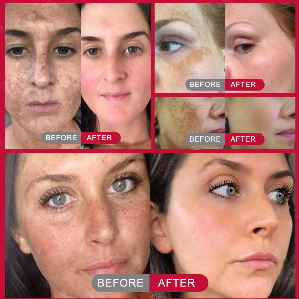 Powerful Spot-removing Whiteni - Charcoal Whitening Paste recension och pris