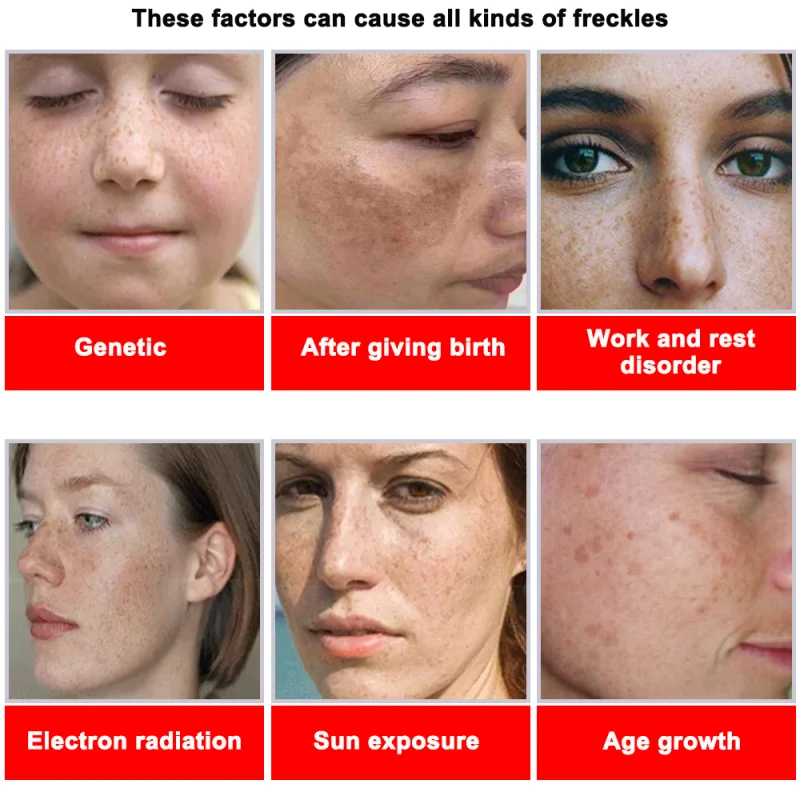 Powerful Spot-removing Whiteni - Charcoal Whitening Paste recension och pris