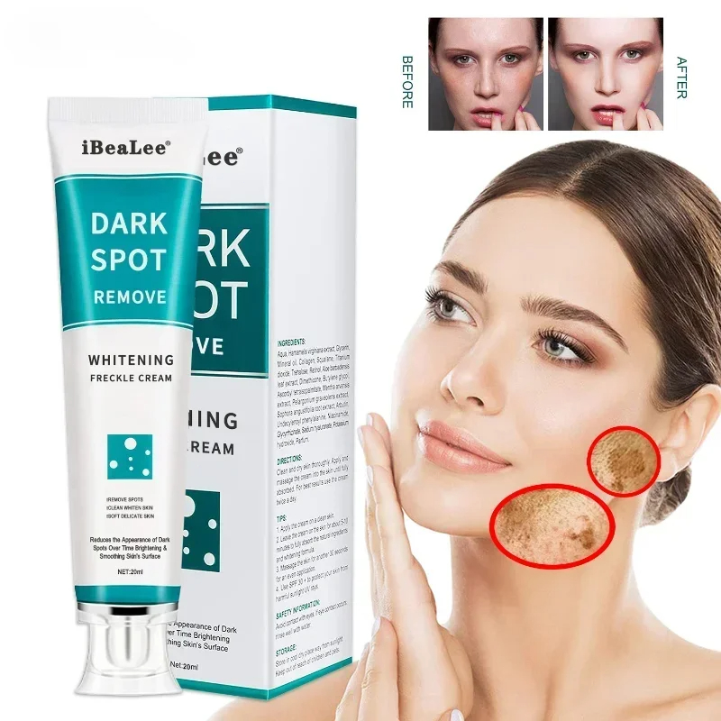 Whitening Freckle Cream Remove - Charcoal Whitening Paste recension och pris