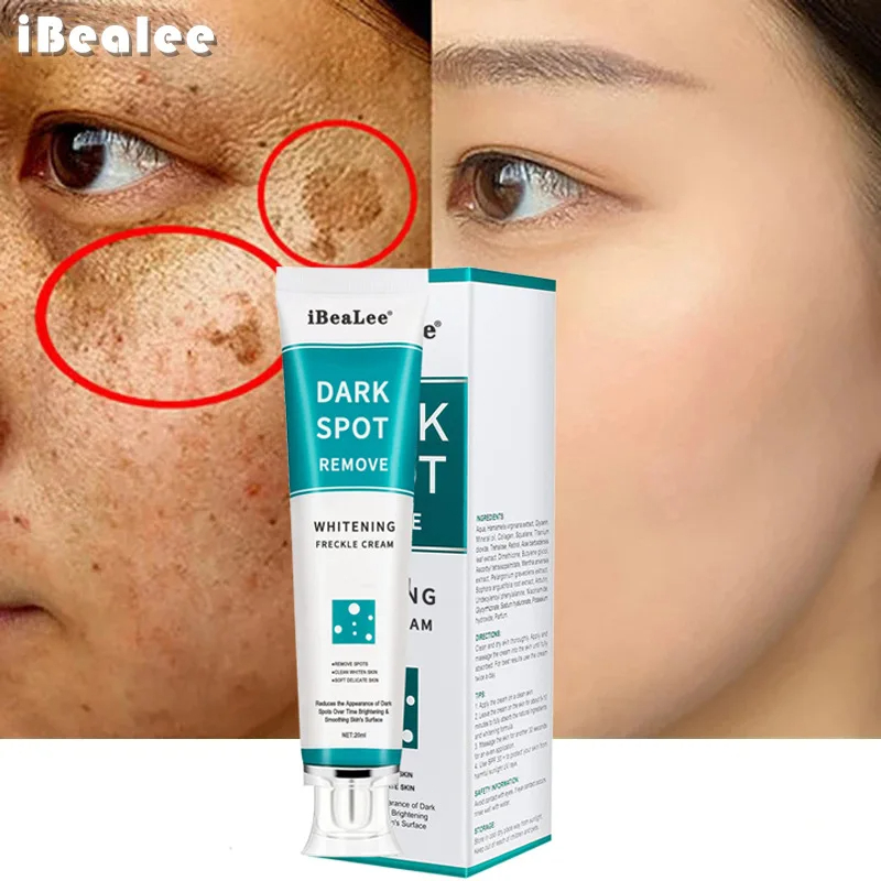 Whitening Freckle Cream Remove - Charcoal Whitening Paste recension och pris
