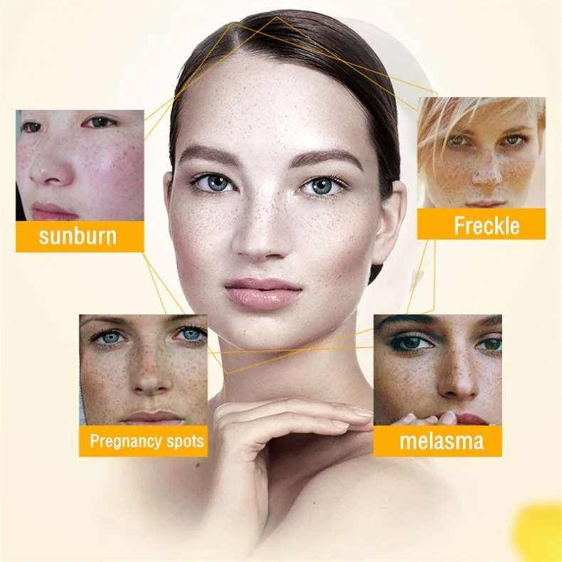 Whitening Freckle Cream Remove - Charcoal Whitening Paste recension och pris