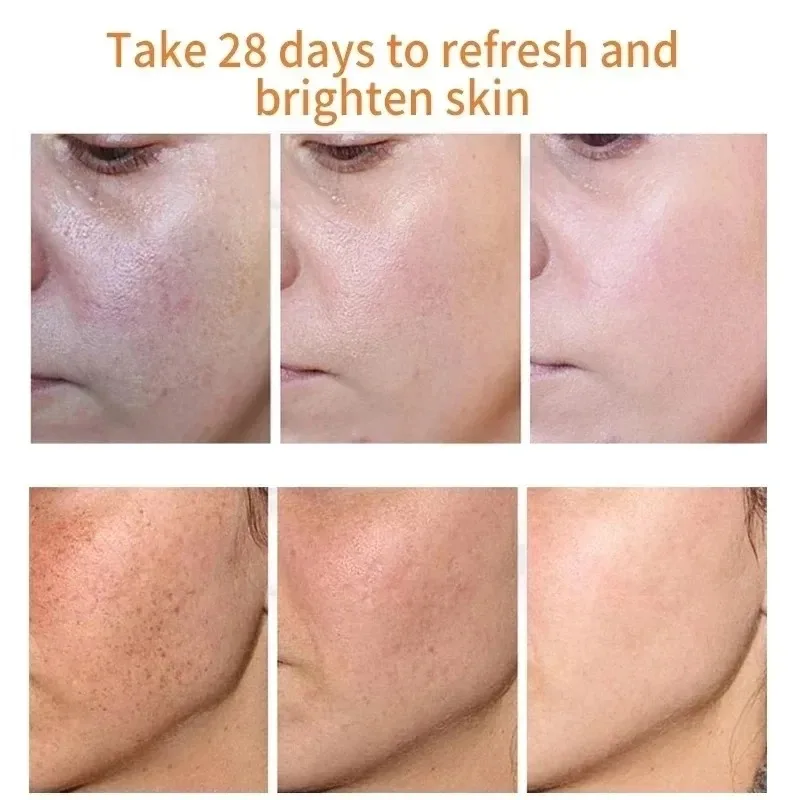 Fades Freckle Dark Spots Face  - Charcoal Whitening Paste recension och pris