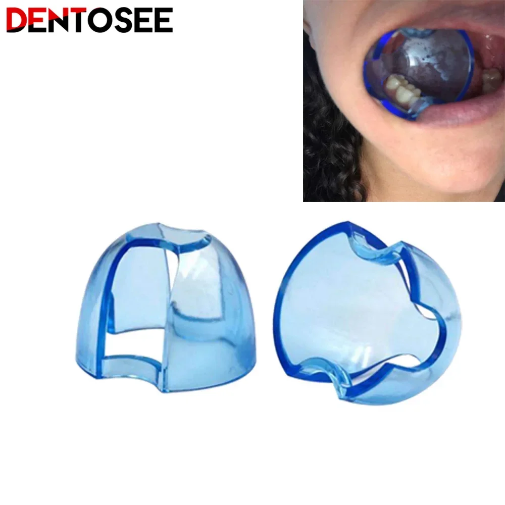 Dental Intraoral Cheek Retract - Teeth Whitening Zoom recension och pris