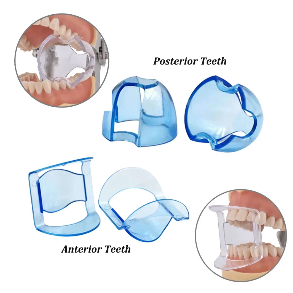 Dental Intraoral Cheek Retract - Teeth Whitening Zoom recension och pris