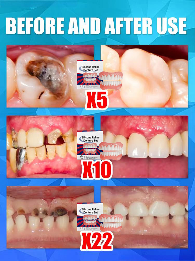 False Teeth Silicone Upper Low - Teeth Whitening For Braces recension och pris