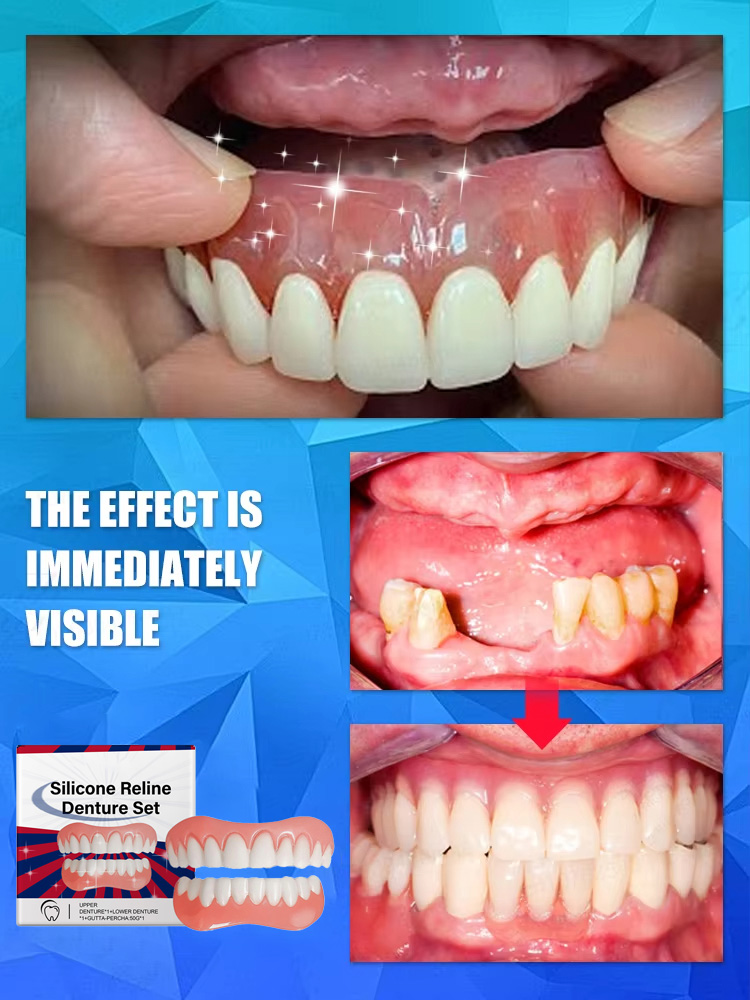 False Teeth Silicone Upper Low - Teeth Whitening For Braces recension och pris