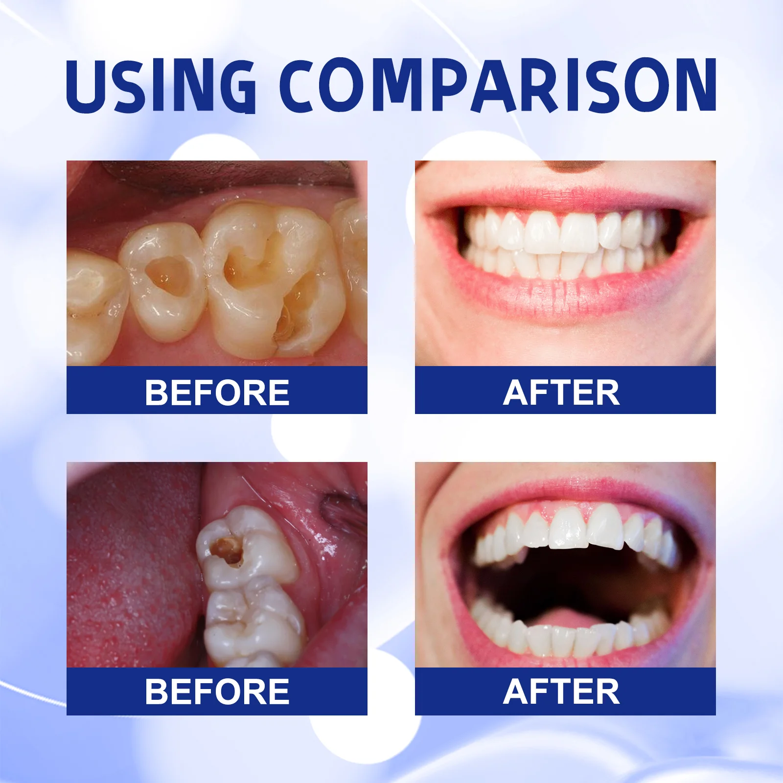 ⁹⁹% ᵒᶠ ᵖᵉᵒᵖˡᵉ ʳᵉᵖᵘʳᶜʰᵃˢᵉ ᵗᵒ ʳᵉ - Remineralizing Toothpaste recension och pris
