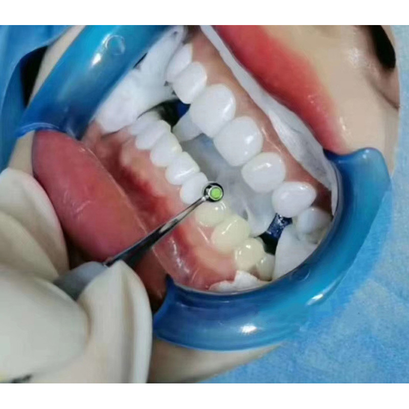 Dental Resin Filling Spatula D - Teeth Whitening Foam recension och pris