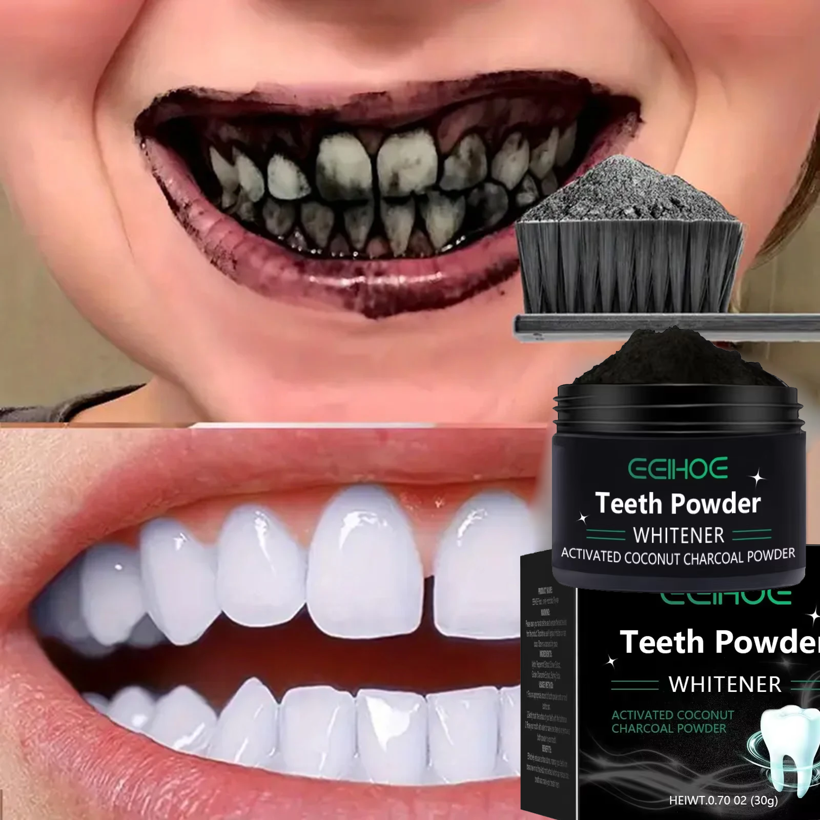 Teeth Brightening Whitening Po - Teeth Whitening Near Me recension och pris